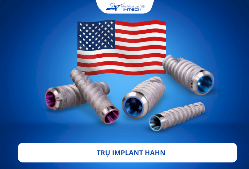 Trụ Implant Hahn: Nguồn gốc, cấu tạo và ưu điểm nổi bật
