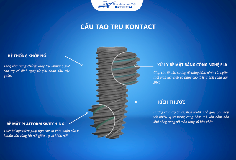 Trụ Implant Kontact được nghiên cứu nhiều năm và cải tiến liên tục với thiết kế ngày càng tối ưu hóa quá trình tích hợp xương