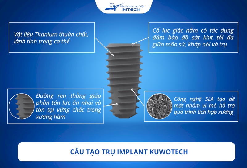 Từ A-Z về trụ Implant Kuwotech: Nguồn gốc, cấu tạo & chi phí