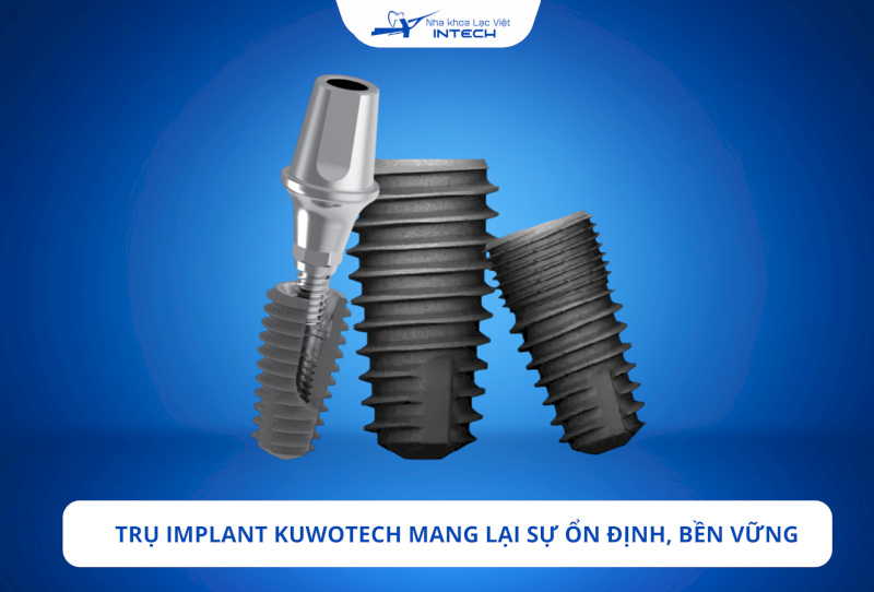 Trụ Implant Kuwotech có độ bền cao, ổn định cao nhờ vào vật liệu Titanium và thiết kế đặc biệt