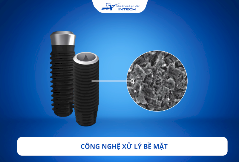 Công nghệ RBM giúp bề mặt trụ sạch sẽ kích thích các tế bào xương, giúp tích hợp xương nhanh chóng 