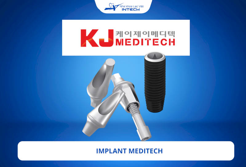 Trụ Implant Meditech: Xuất xứ, đặc điểm và chi phí