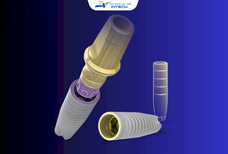 Chi phí cấy ghép răng Implant MIS C1 thường dao động tùy thuộc vào các cơ sở nha khoa khác nhau