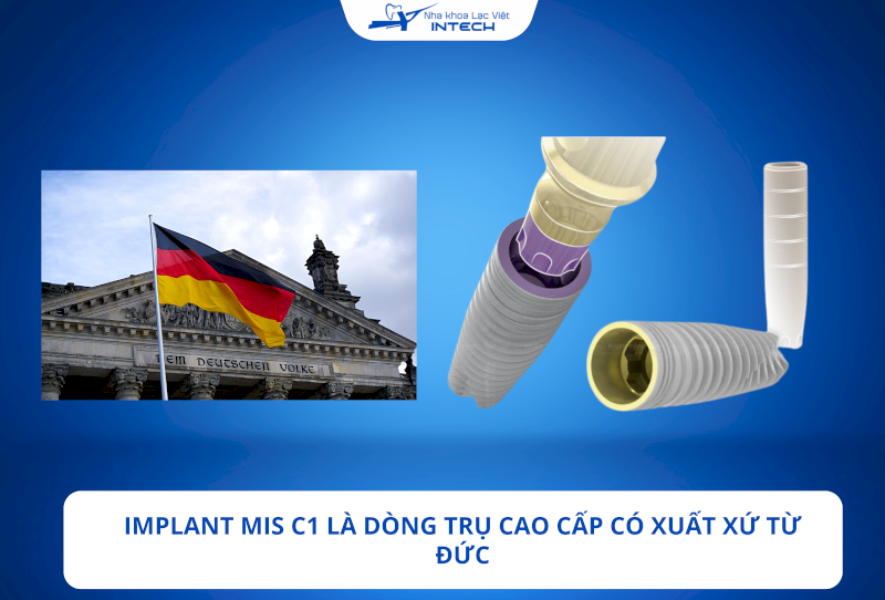Tìm hiểu chi tiết trụ Implant MIS C1 có tốt không?