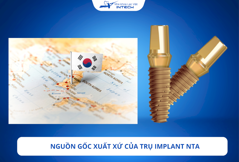 Giới thiệu trụ Implant NTA: Xuất xứ, cấu tạo và chi phí
