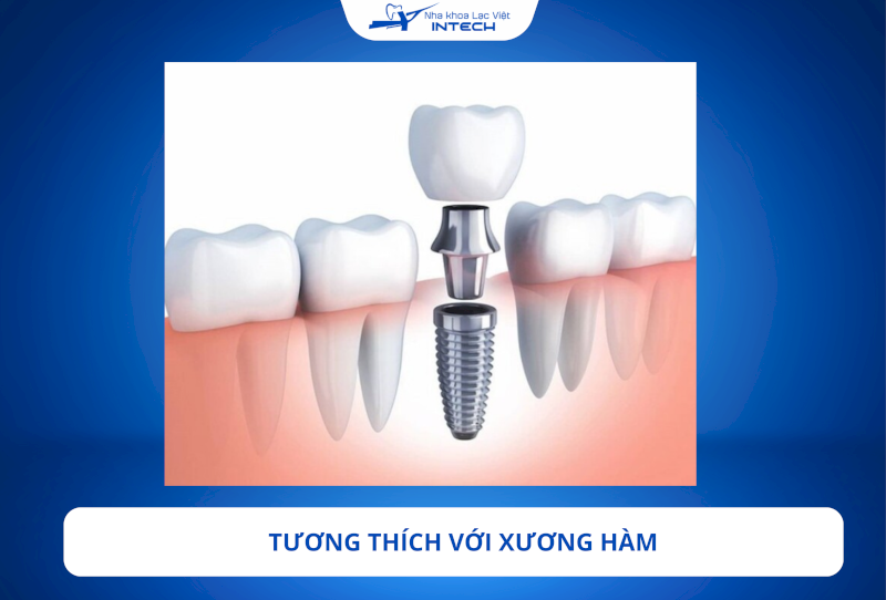 Trụ NTA tích hợp tốt với xương hàm, thúc đẩy quá trình lành thương nhanh chóng