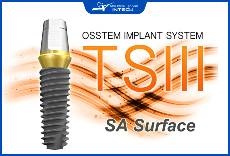 Implant Osstem có thời gian tích hợp lâu hơn các dòng cao cấp nhưng vẫn đảm bảo hiệu quả điều trị với mức chi phí lý tưởng