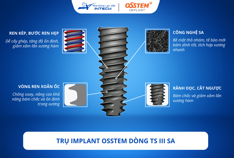 Trụ Implant Osstem đang phân phối phổ biến ở thị trường Việt Nam thường sử dụng công nghệ xử lý bề mặt SA có khả năng thúc đẩy tích hợp xương