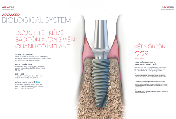 Trụ Implant Paltop được làm từ hợp kim Titanium, loại vật liệu cao cấp có độ tinh khiết và độ bền cơ học vượt trội