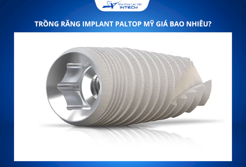 Chi phí trồng răng Implant Paltop có thể thay đổi tùy thuộc vào tình trạng mất răng, nhu cầu phục hình của mỗi người
