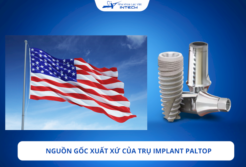 Trụ Implant Paltop có xuất xứ từ quốc gia nào? Có tốt không?