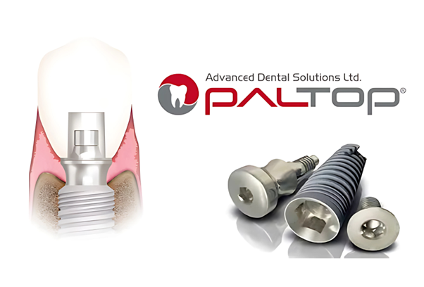Trụ Implant Paltop không chỉ được đánh giá cao về chất lượng vật liệu mà còn sở hữu nhiều đặc điểm kỹ thuật tối ưu