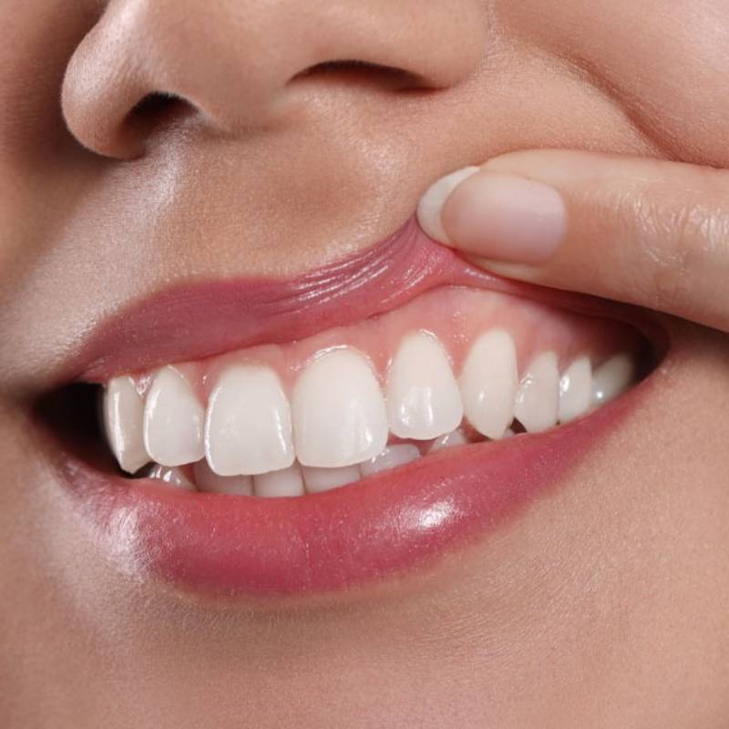 Các phương pháp trồng Implant áp dụng công nghệ hiện đại sẽ đảm bảo đường viền nướu như răng thật 