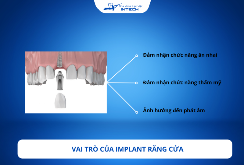 Răng cửa ảnh hưởng lớn đến tính thẩm mỹ và nhiều chức năng khác nhau trên khuôn mặt 
