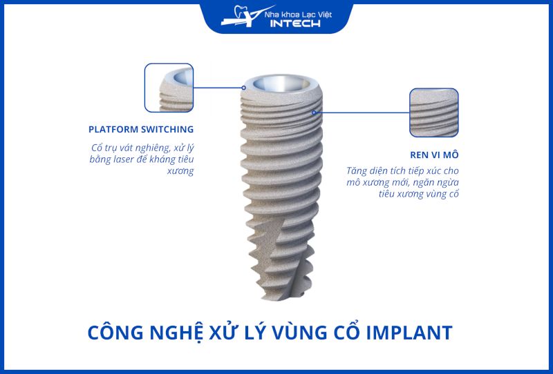 Trụ Implant Titanium tốt phải được xử lý vùng cổ tốt do đây là vùng chịu lực nhiều, dễ bị tiêu xương
