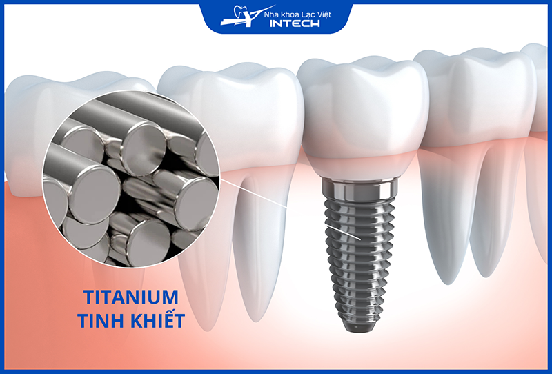 Titanium tinh khiết là vật liệu được Bộ Y Tế chứng nhận an toàn, lành tính với cơ thể con người