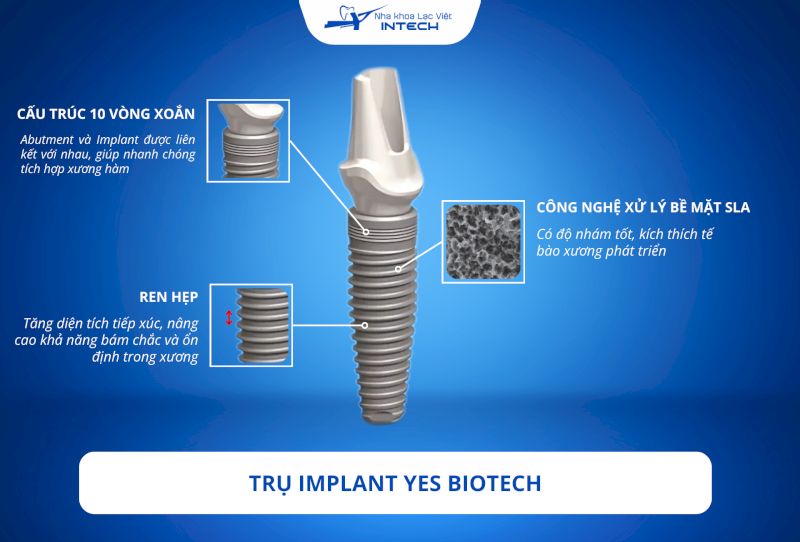 Nguồn gốc, cấu tạo, giá trụ Implant Yes Biotech 2025