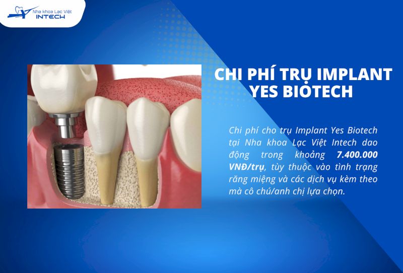 Trụ Implant Yes Biotech có mức giá rẻ hơn so với các loại trụ khác, phù hợp với nhu cầu trồng nhiều răng của khách hàng