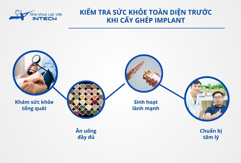 Trước khi tiến hành cấy ghép Implant, kiểm tra sức khỏe toàn diện là bước không thể thiếu để đảm bảo ca phẫu thuật diễn ra suôn sẻ và đạt kết quả tốt nhất 