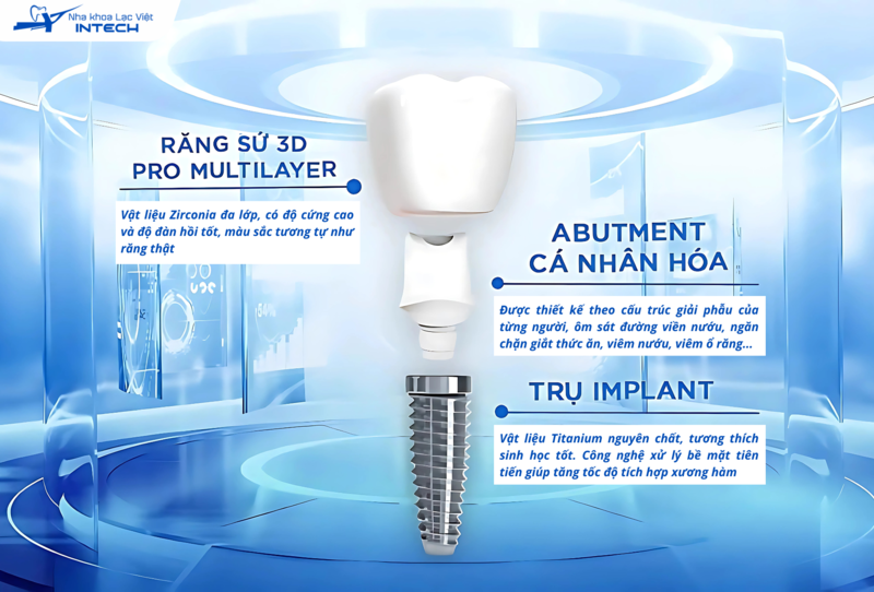 Một răng Implant chất lượng phải được cấu thành từ 3 bộ phận đảm bảo chất lượng