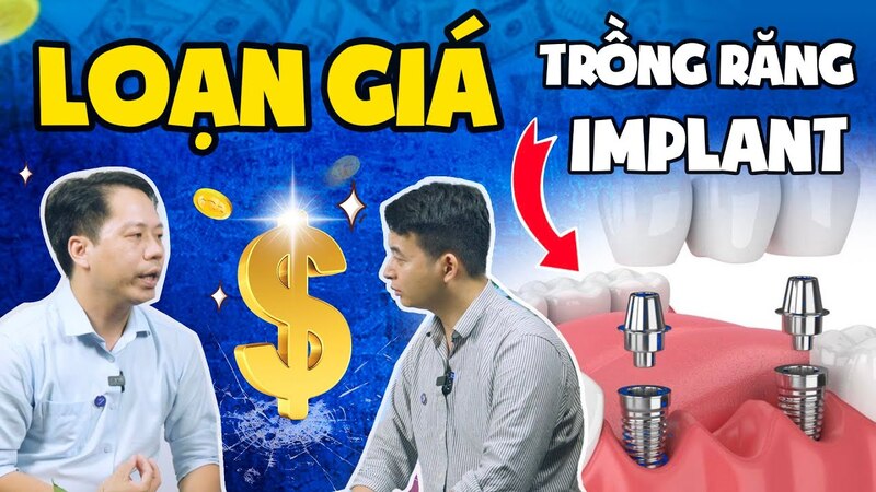 Thực trạng loạn giá trồng răng Implant diễn ra khiến nhiều người hoang mang, hiểu sai lệch về phương pháp phục hình răng này
