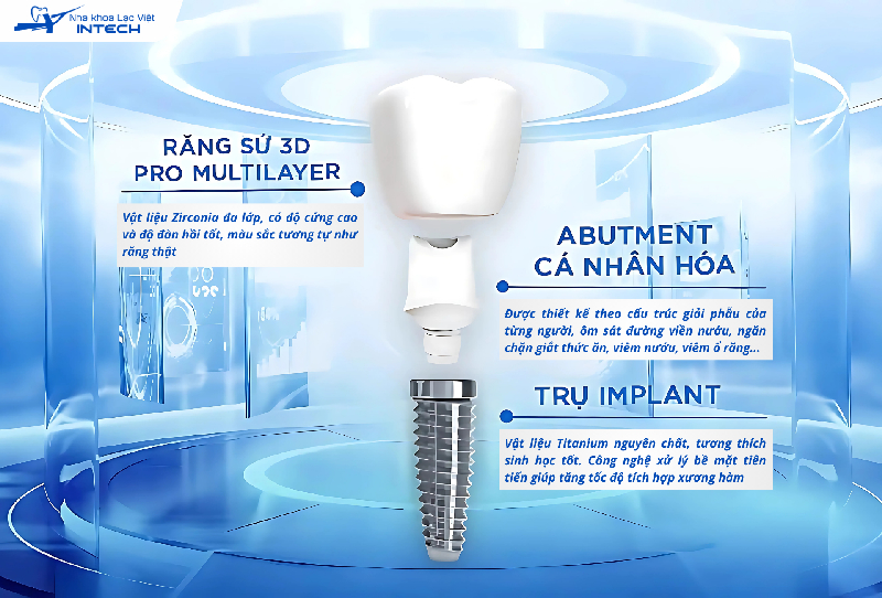răng implant cần đảm bảo gì