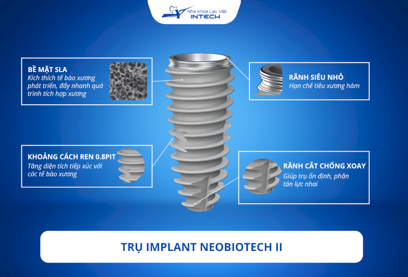 NeoBiotech Implant là gì? 5 ưu điểm của trụ Implant II NeoBiotech