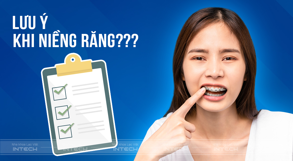 niềng răng bao lâu thì tháo
