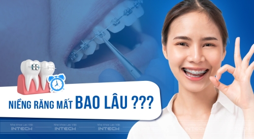 Niềng răng bao lâu thì tháo? Mất bao nhiêu thời gian để có kết quả?