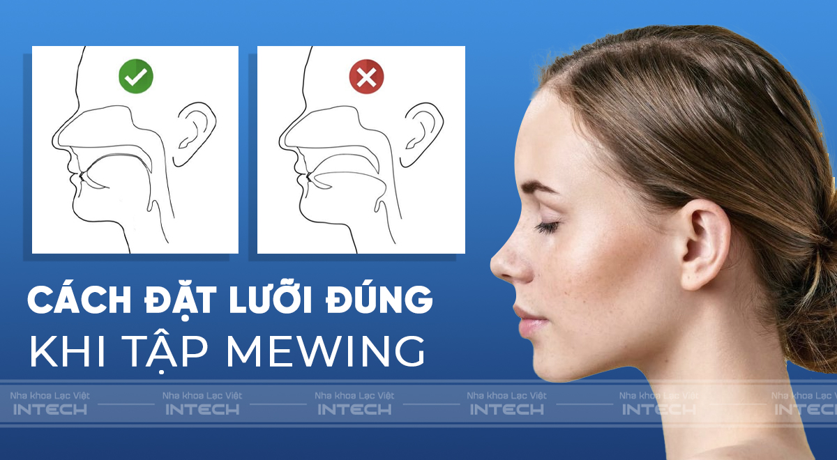 Tập Mewing đúng cách giúp hạn chế tình trạng hóp má