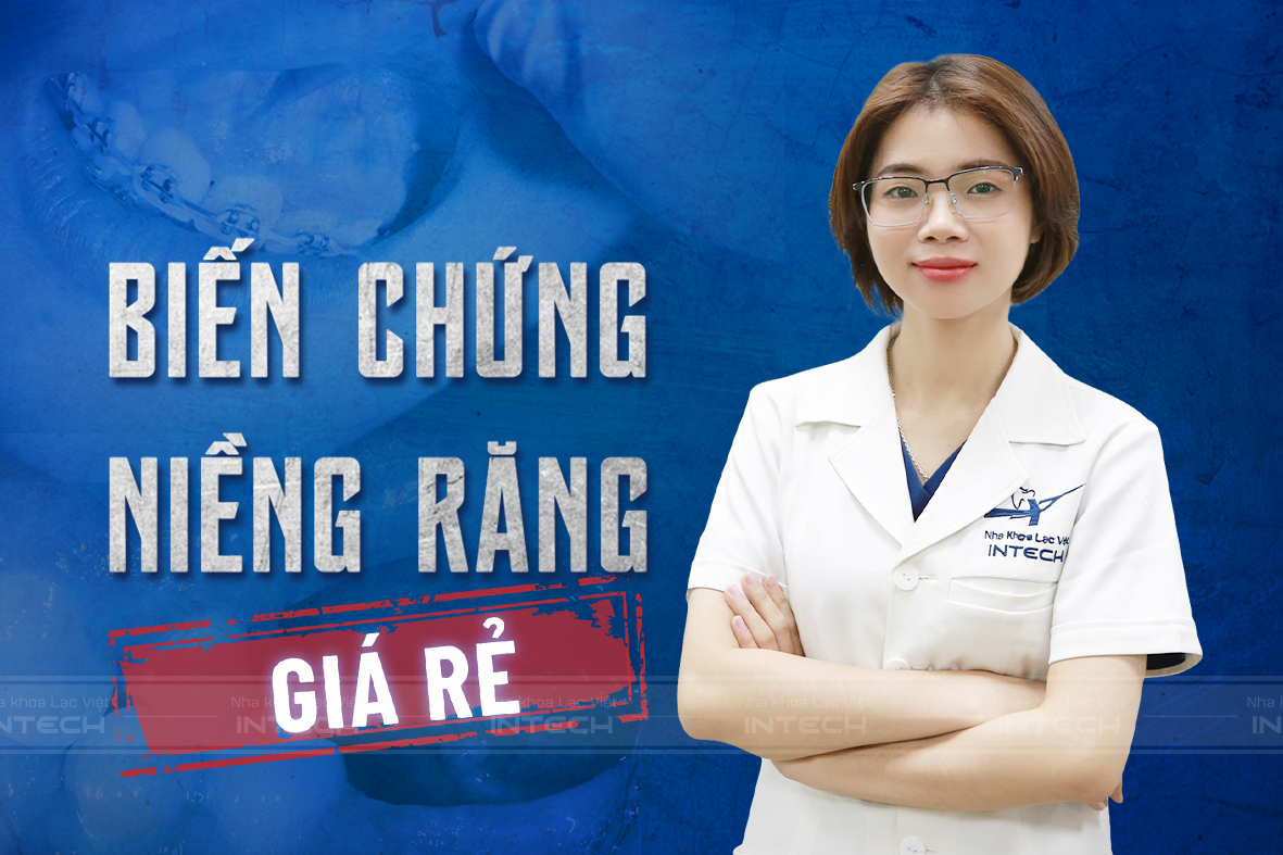 bảng giá niềng răng rẻ nhất