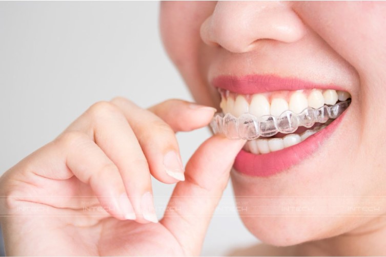 Khay niềng có thể tháo lắp dễ dàng