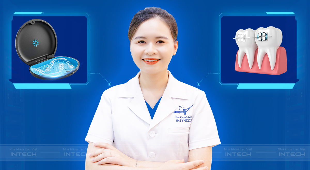 niềng răng khớp căn ngược giá bao nhiêu
