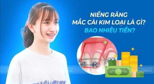 Niềng răng mắc cài kim loại là gì? Giá bao nhiêu? Ưu nhược điểm