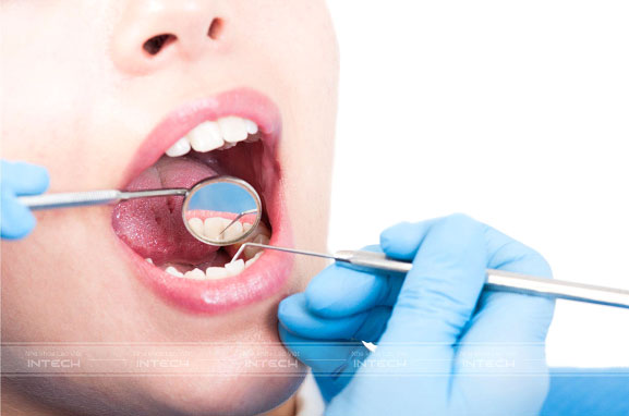 niềng răng mắc cài mặt trong