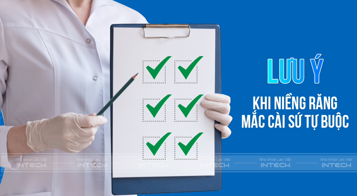 niềng răng mắc cài sứ tự buộc là gì