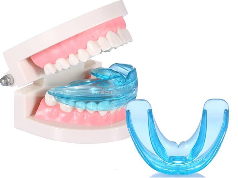 bộ niềng răng tại nhà