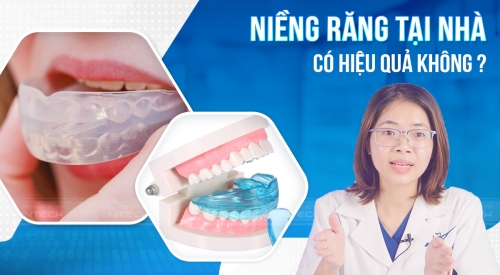 Bộ dụng cụ niềng răng tại nhà gồm những gì? Có hiệu quả không?
