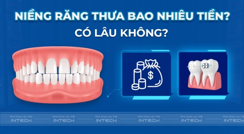 Niềng răng thưa bao nhiêu tiền? Có lâu không? Cần lưu ý những gì?