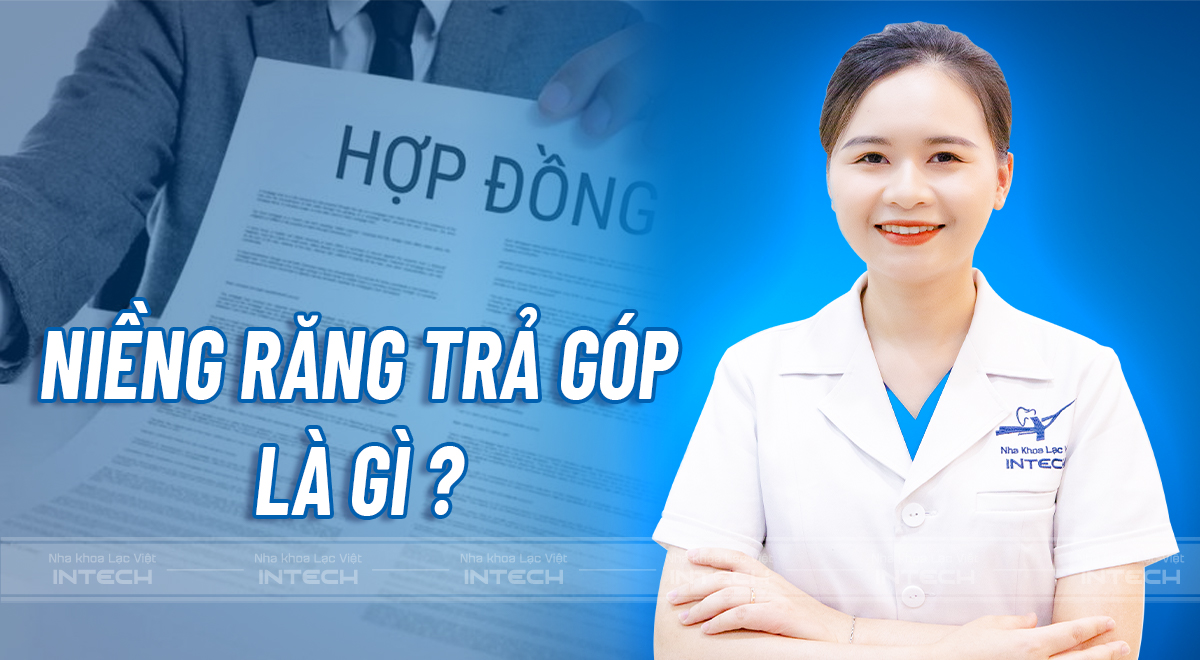 Trả góp niềng răng