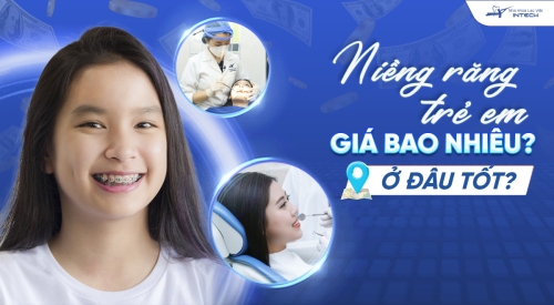 Niềng răng trẻ em giá bao nhiêu? Ở đâu tốt? Bác sĩ chỉnh nha chia sẻ