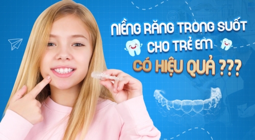 Niềng răng trong suốt cho trẻ em có hiệu quả? Những lưu ý cha mẹ cần nắm rõ