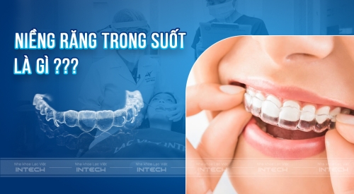Niềng răng trong suốt là gì? Giá bao nhiêu tiền? Có hiệu quả không?