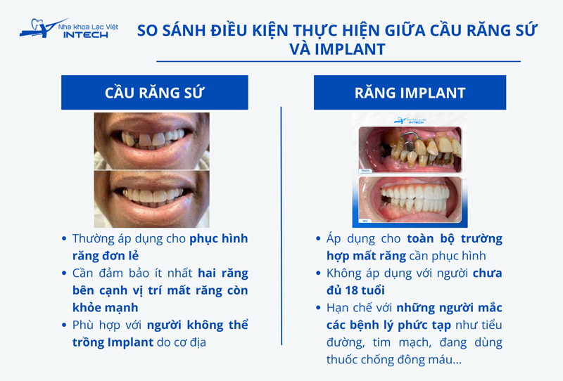 Mỗi phương pháp phục hình răng đều cần đáp ứng đủ những điều kiện riêng để đảm bảo an toàn