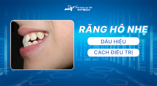 RĂNG HÔ NHẸ CÓ NÊN NIỀNG KHÔNG? 3 DÁU HIỆU CẦN BIẾT 