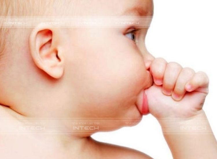 cách nhận biết răng hô