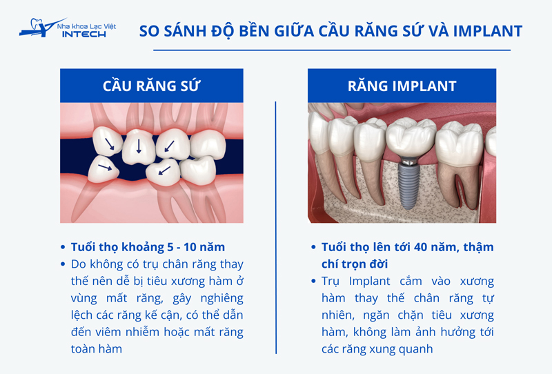 Răng Implant có tuổi thọ gấp 2 - 3 lần cầu răng sứ, có thể bảo tồn vĩnh viễn