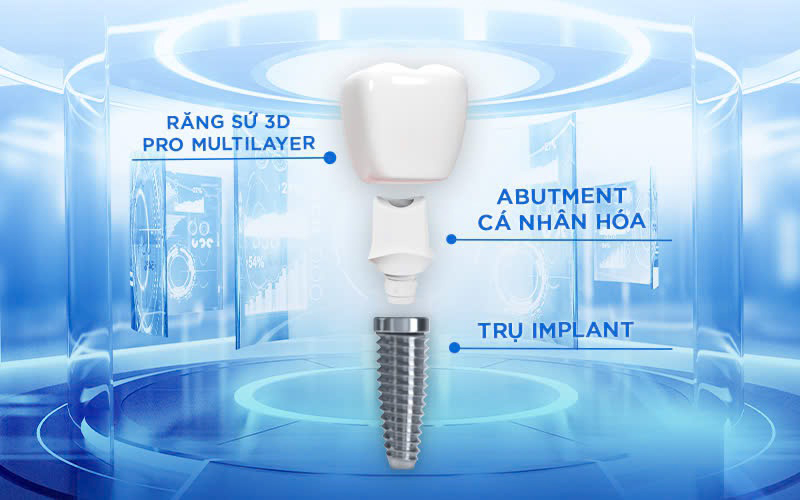 Trồng răng Implant