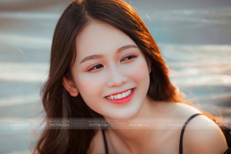 Răng khểnh giúp tôn lên nét duyên dáng của người sở hữu