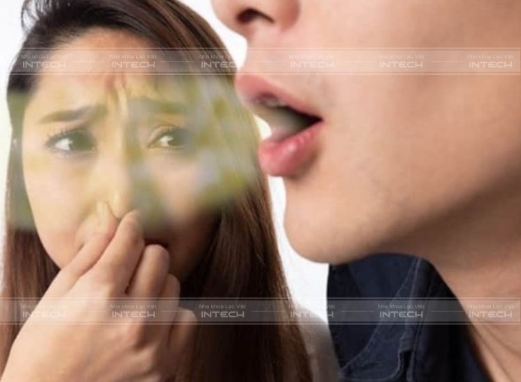 Răng khôn khiến hơi thở có mùi